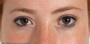 eyes